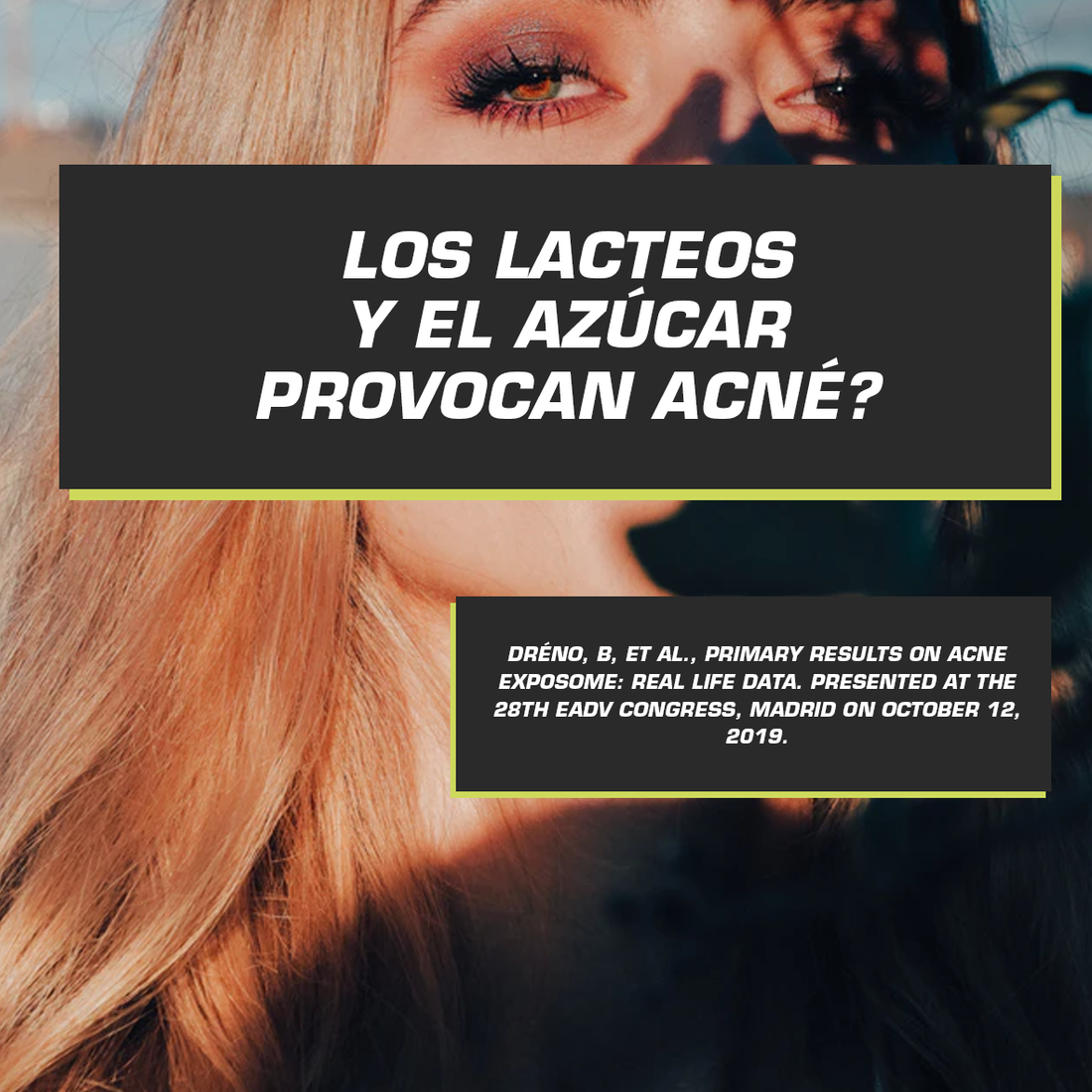 LOS LÁCTEOS Y EL AZÚCAR PROVOCAN ACNÉ?