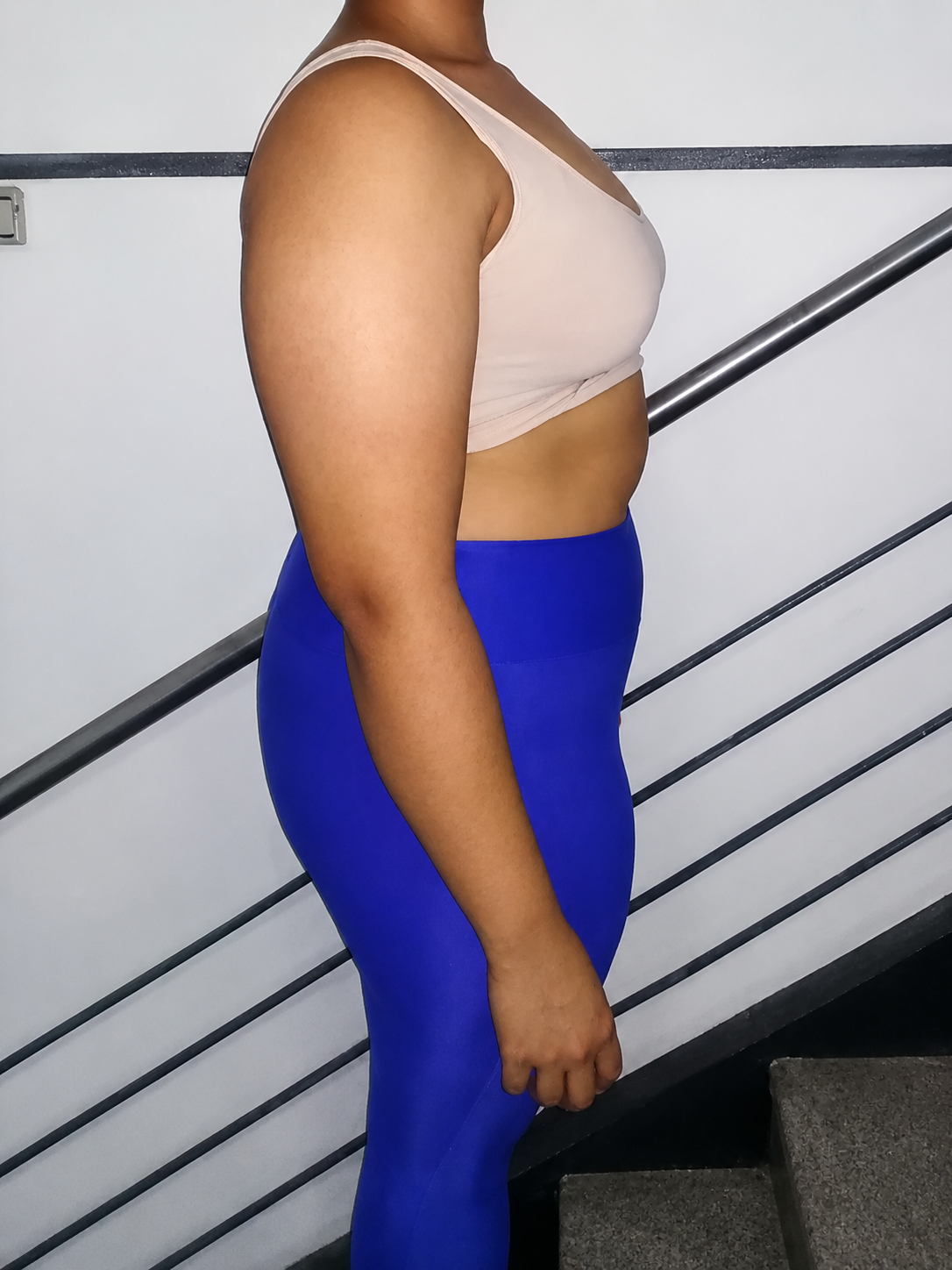 Deyanira Londoño antes